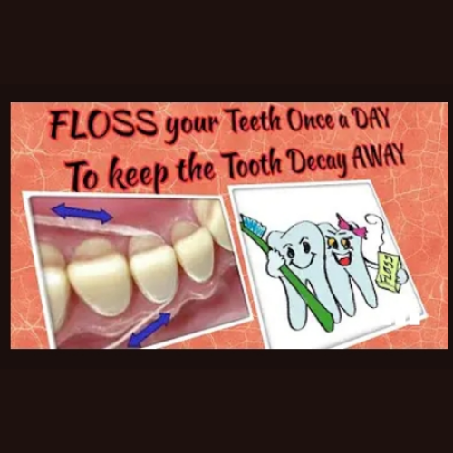 Teeth Cleaning/ Scaling Treatment