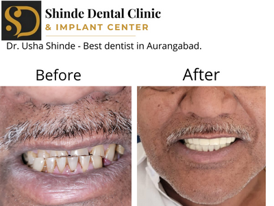 Shinde Dental Clinic and Implant Center