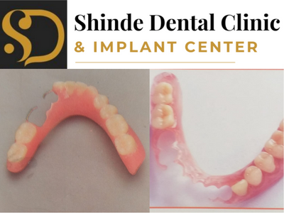Partial denture